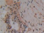 PAK2 Polyclonal Antibody
