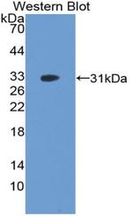 PAK2 Antibody in Western Blot (WB)
