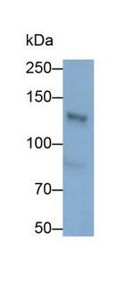Palladin Antibody in Western Blot (WB)