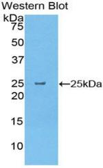 CELA1 Antibody in Western Blot (WB)
