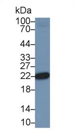 DJ-1 Antibody in Western Blot (WB)