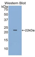 DJ-1 Antibody in Western Blot (WB)
