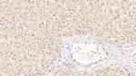 PEX2 Polyclonal Antibody