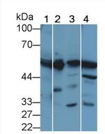 PAH Polyclonal Antibody