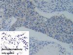 PFKP Antibody in Immunohistochemistry (Paraffin) (IHC (P))