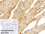 PFKP Antibody in Immunohistochemistry (Paraffin) (IHC (P))