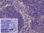 PFKP Antibody in Immunohistochemistry (Paraffin) (IHC (P))