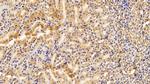 PFKP Antibody in Immunohistochemistry (Paraffin) (IHC (P))