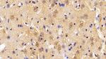 PFKP Antibody in Immunohistochemistry (Paraffin) (IHC (P))