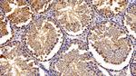 PFKP Antibody in Immunohistochemistry (Paraffin) (IHC (P))