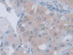 PGM1 Antibody in Immunohistochemistry (Paraffin) (IHC (P))