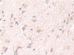 PGM1 Antibody in Immunohistochemistry (Paraffin) (IHC (P))