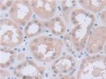 PGM1 Antibody in Immunohistochemistry (Paraffin) (IHC (P))