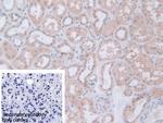 PGM1 Antibody in Immunohistochemistry (Paraffin) (IHC (P))