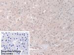 PGM1 Antibody in Immunohistochemistry (Paraffin) (IHC (P))