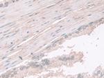 PGM1 Antibody in Immunohistochemistry (Paraffin) (IHC (P))