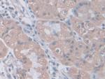 PGM1 Antibody in Immunohistochemistry (Paraffin) (IHC (P))