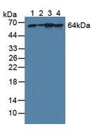PGM1 Antibody in Western Blot (WB)