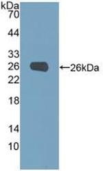 PGM1 Antibody in Western Blot (WB)