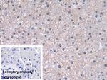 PGK1 Antibody in Immunohistochemistry (Paraffin) (IHC (P))