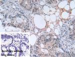 PGK1 Antibody in Immunohistochemistry (Paraffin) (IHC (P))