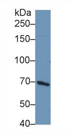 PIK3AP1 Antibody in Western Blot (WB)