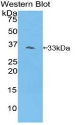 PIK3AP1 Antibody in Western Blot (WB)