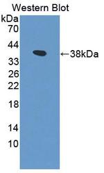 PIK3AP1 Antibody in Western Blot (WB)