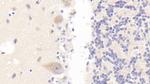 PLB1 Polyclonal Antibody