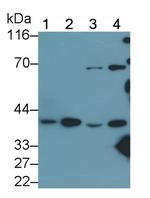 PSAT1 Antibody in Western Blot (WB)