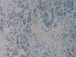PACAP Polyclonal Antibody