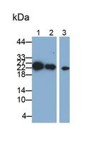 PAFAH1B3 Antibody in Western Blot (WB)