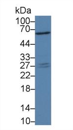 PAFAH1B3 Antibody in Western Blot (WB)