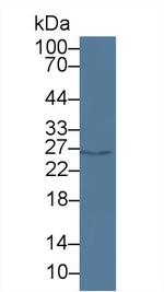 PAFAH1B3 Antibody in Western Blot (WB)