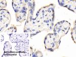 PAPPA Polyclonal Antibody