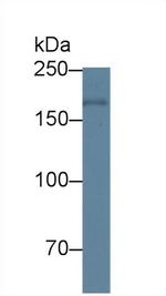 PAPPA Antibody in Western Blot (WB)