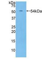 PZP Antibody in Western Blot (WB)