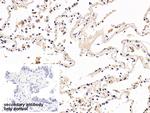 PD-1 Antibody in Immunohistochemistry (Paraffin) (IHC (P))