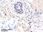 PD-1 Antibody in Immunohistochemistry (Paraffin) (IHC (P))