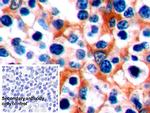 PD-1 Antibody in Immunohistochemistry (Paraffin) (IHC (P))