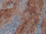 PD-1 Antibody in Immunohistochemistry (Paraffin) (IHC (P))