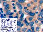PD-1 Antibody in Immunohistochemistry (Paraffin) (IHC (P))