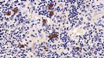PD-1 Antibody in Immunohistochemistry (Paraffin) (IHC (P))