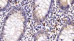 PD-1 Antibody in Immunohistochemistry (Paraffin) (IHC (P))