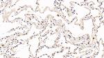 PD-1 Antibody in Immunohistochemistry (Paraffin) (IHC (P))