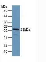 PDCD6 Antibody in Western Blot (WB)