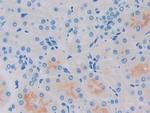 GCDFP-15 Antibody in Immunohistochemistry (Paraffin) (IHC (P))