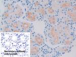 GCDFP-15 Antibody in Immunohistochemistry (Paraffin) (IHC (P))