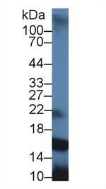 GCDFP-15 Antibody in Western Blot (WB)