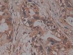 PRCP Polyclonal Antibody
